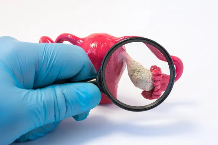 Top 5 symptoms of gynaecological disorders you should be aware of
