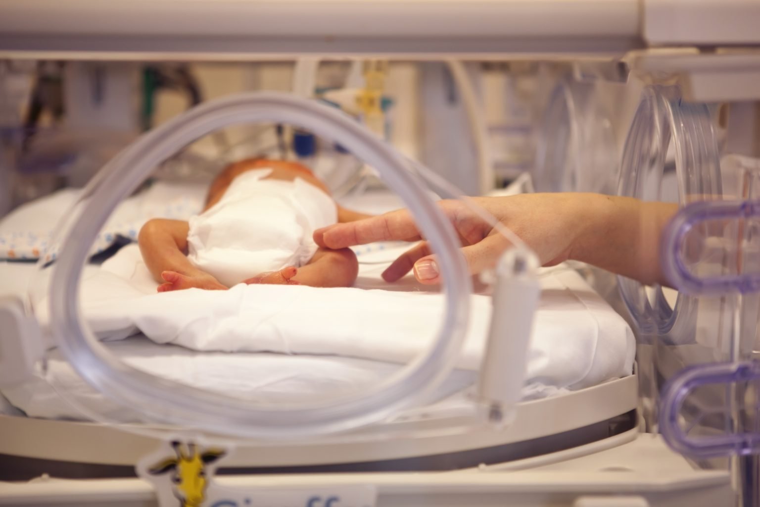 What is low birth weight? Causes & Diagnosis Methods