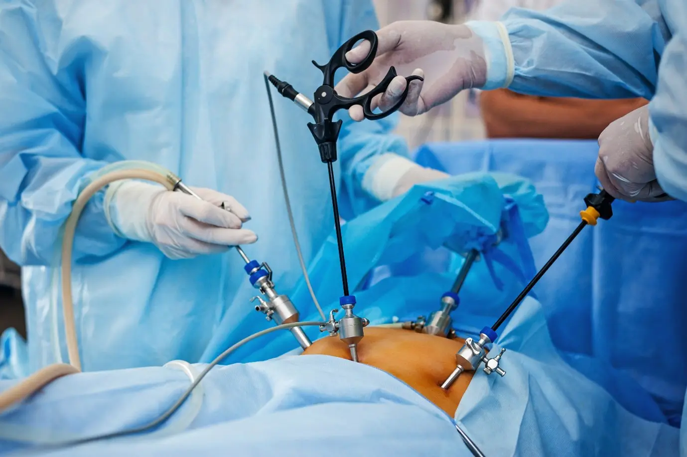 Considering Minimally Invasive Gynecologic Surgery?